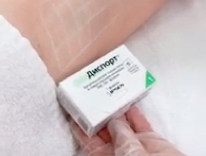 Процедура ботулинотерапит лечение гипергидроза фото