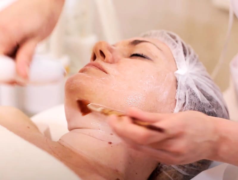 Процедура RF-лифтинга омоложения фото 