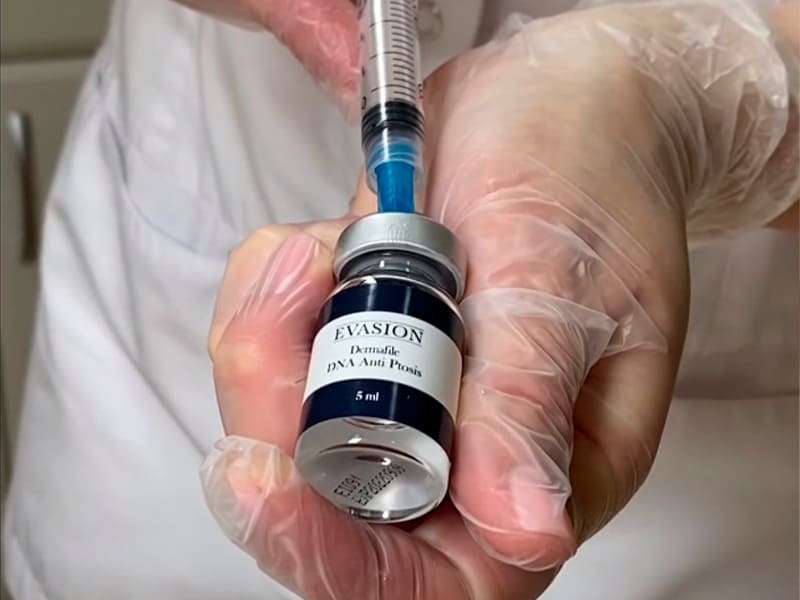 Процедура мезотерапии фото 