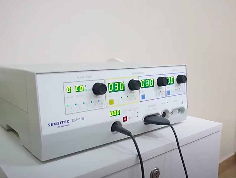 Процедура удаления новообразований фото 