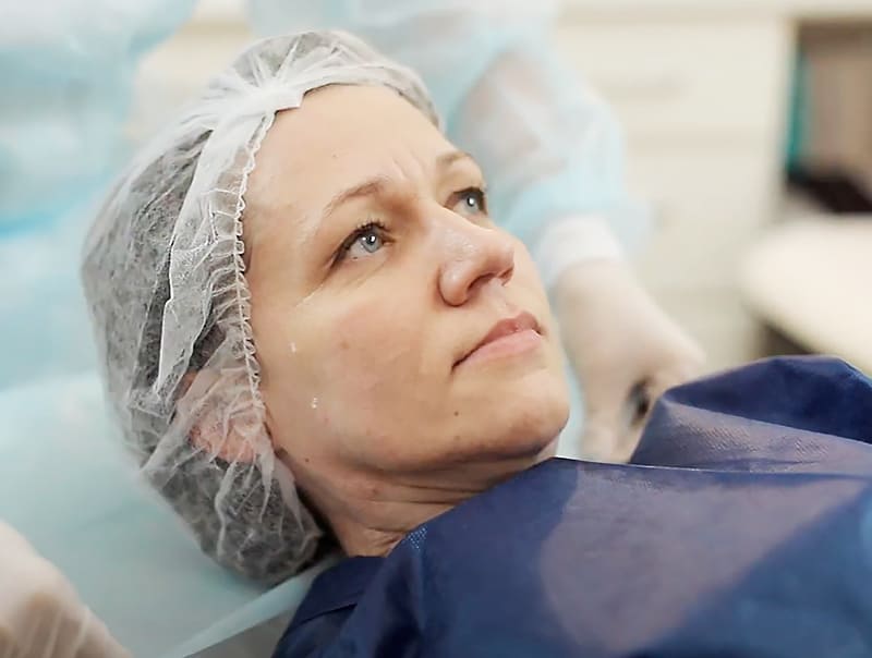 Процедура тредлифтинга фото