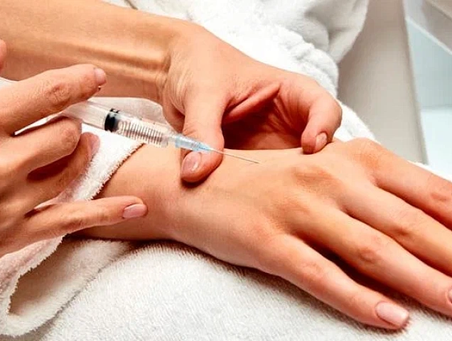 Процедура биоревитализации рук фото 2