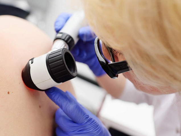 Процедура дерматоскопии фото