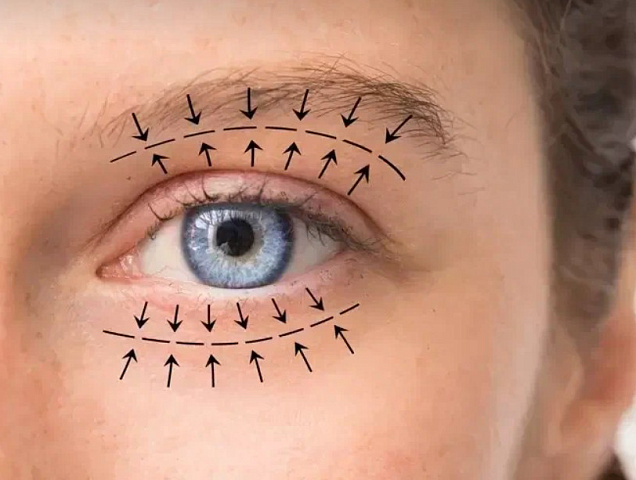 Процедура SMAS лифтинга глаз фото 1