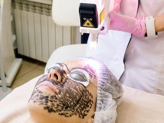 Процедура карбонового пилинга фото 4