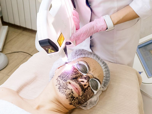 Процедура карбонового пилинга фото 1