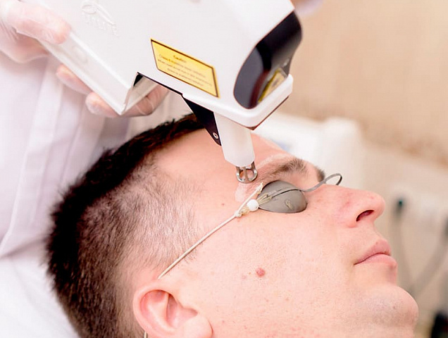 Процедура лазерного омоложения RecoSMA лица для мужчин фото 1