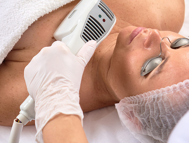 Процедура фотоэпиляции фото 2