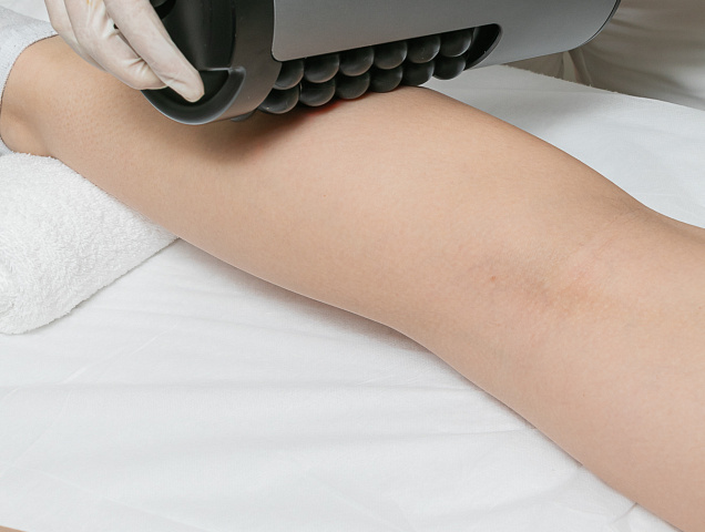 Процедура RSL-скульптурирование для мужчин фото 2 Процедура RSL-скульптурирование для мужчин фото 2