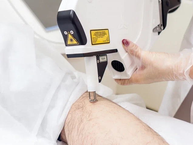 Процедура удаления рубцов RecoSMA фото 4