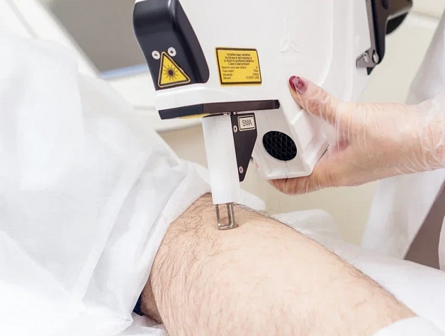 Процедура удаления рубцов RecoSMA фото 3