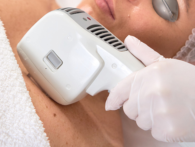 Процедура фотоэпиляции фото