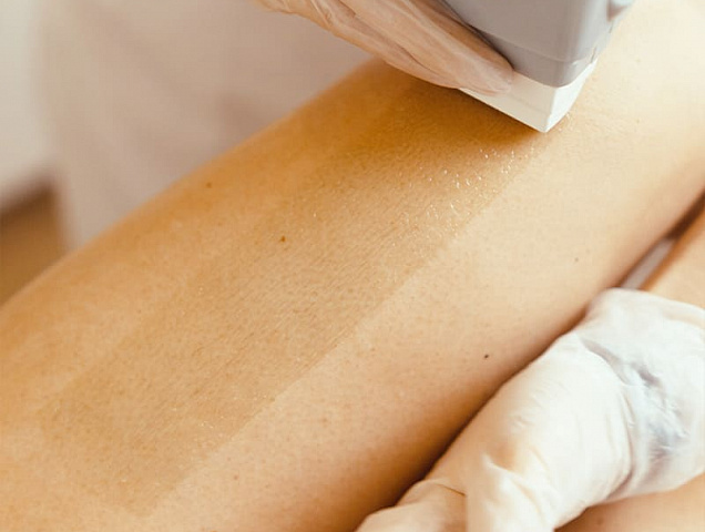 Процедура восковой эпиляции шугаринг фото 1