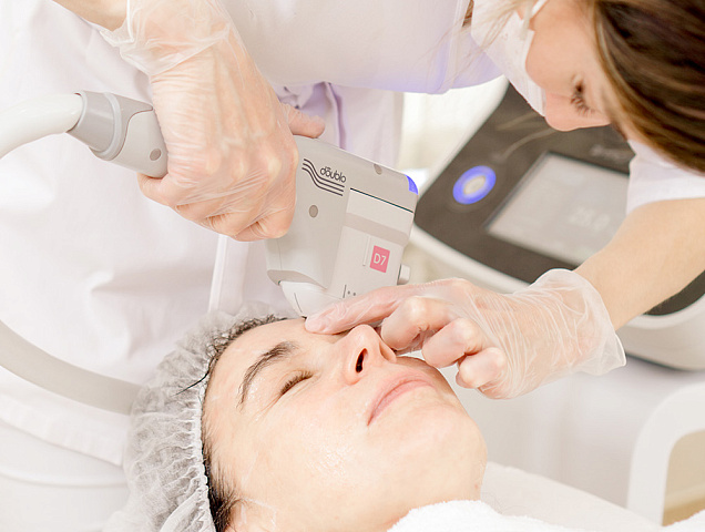 Процедура SMAS лифтинга глаз фото