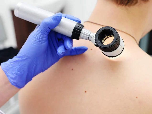 Процедура дерматоскопии фото