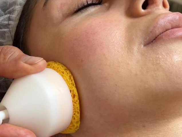 Биожени Biogénie 1